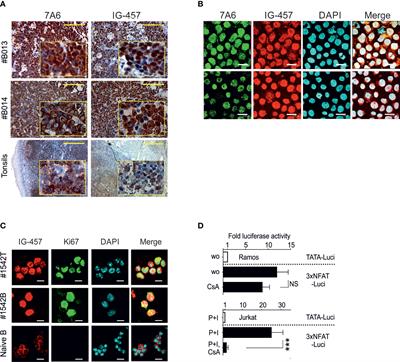 Calcineurin-independent NFATc1 signaling is essential for survival of Burkitt lymphoma cells